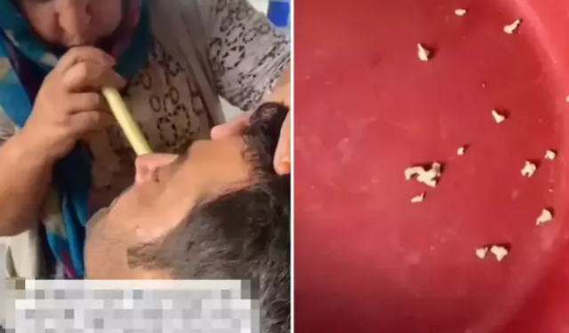 Hindistan Değil Adana! Bu Saçmalığa İnanıp Tedavi İçin Gidenler Var