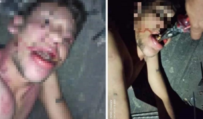 Yer Antalya: Maaşını İsteyen Gencin Kerpetenle Dişlerini Söktüler